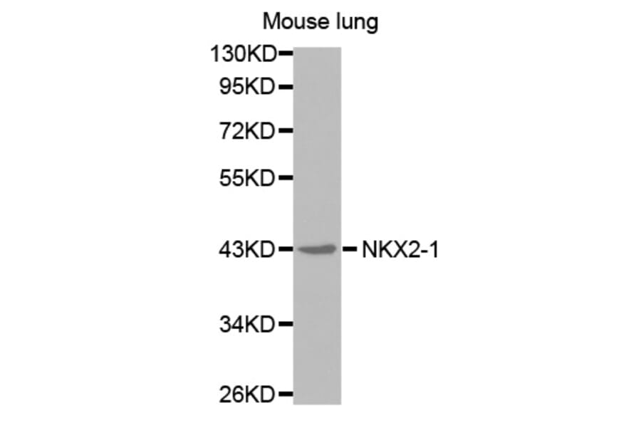 Western blot - NKX2-1 antibody from Signalway Antibody (38577) - Antibodies.com