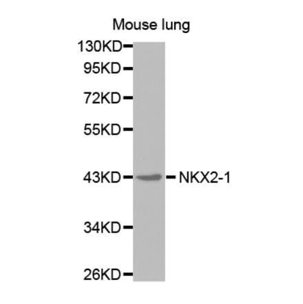 Western blot - NKX2-1 antibody from Signalway Antibody (38577) - Antibodies.com