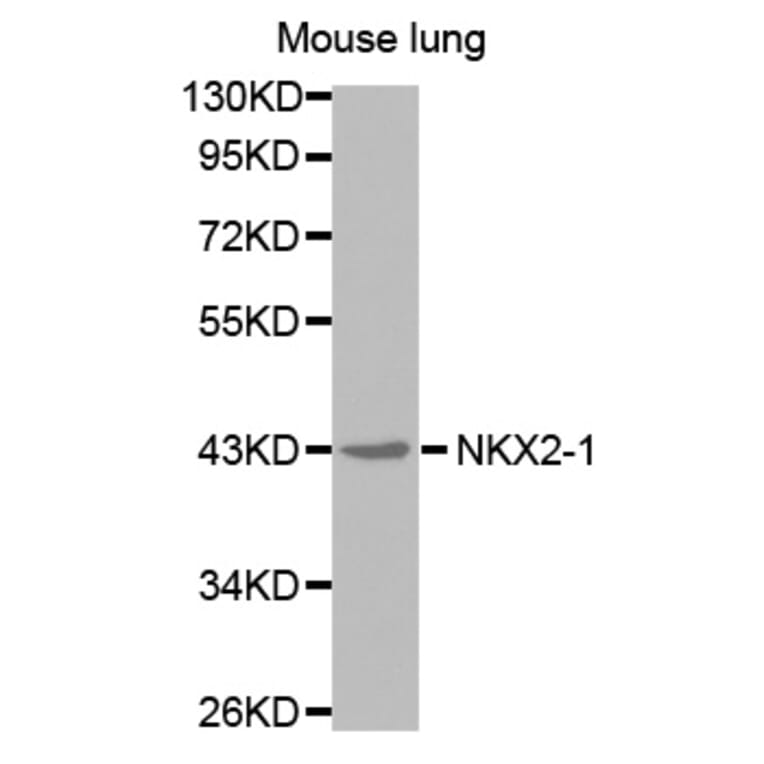 Western blot - NKX2-1 antibody from Signalway Antibody (38577) - Antibodies.com