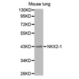 Western blot - NKX2-1 antibody from Signalway Antibody (38577) - Antibodies.com