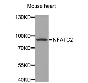 Western blot - NFATC2 antibody from Signalway Antibody (38582) - Antibodies.com