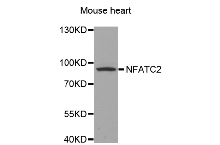 Western blot - NFATC2 antibody from Signalway Antibody (38582) - Antibodies.com