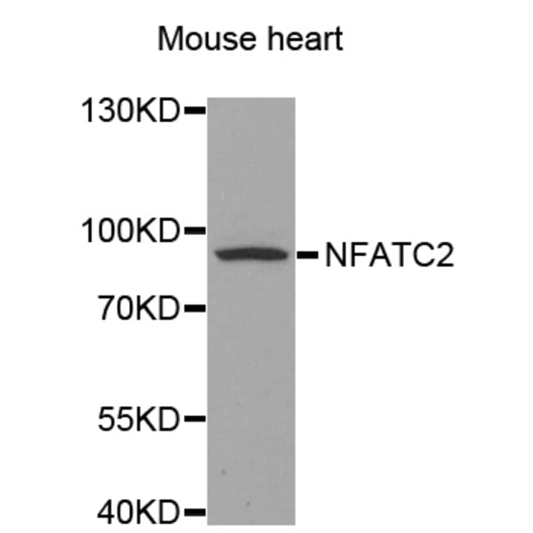 Western blot - NFATC2 antibody from Signalway Antibody (38582) - Antibodies.com