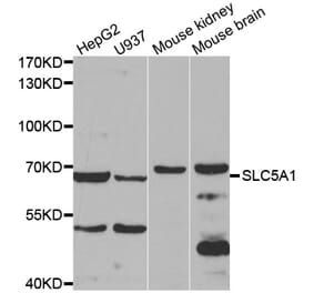 Western blot - SLC5A1 antibody from Signalway Antibody (38596) - Antibodies.com
