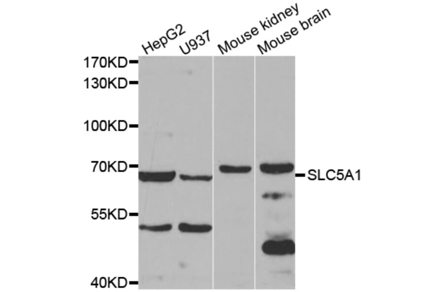 Western blot - SLC5A1 antibody from Signalway Antibody (38596) - Antibodies.com