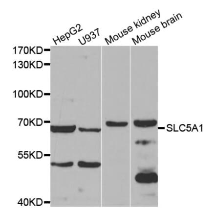 Western blot - SLC5A1 antibody from Signalway Antibody (38596) - Antibodies.com