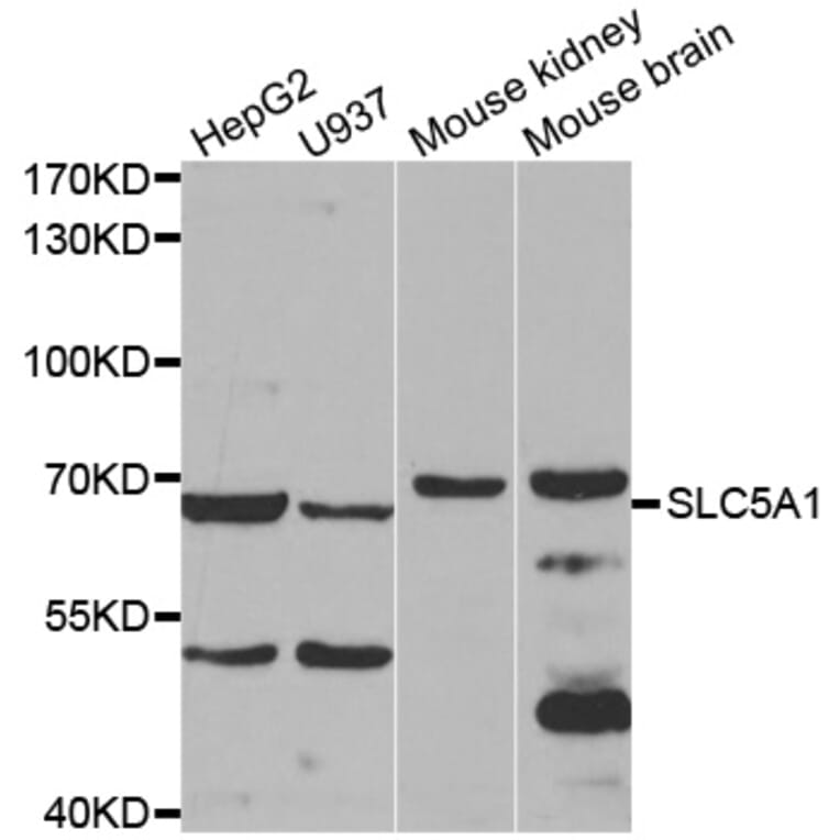 Western blot - SLC5A1 antibody from Signalway Antibody (38596) - Antibodies.com