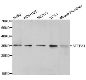 Western blot - SFTPA1 antibody from Signalway Antibody (38598) - Antibodies.com