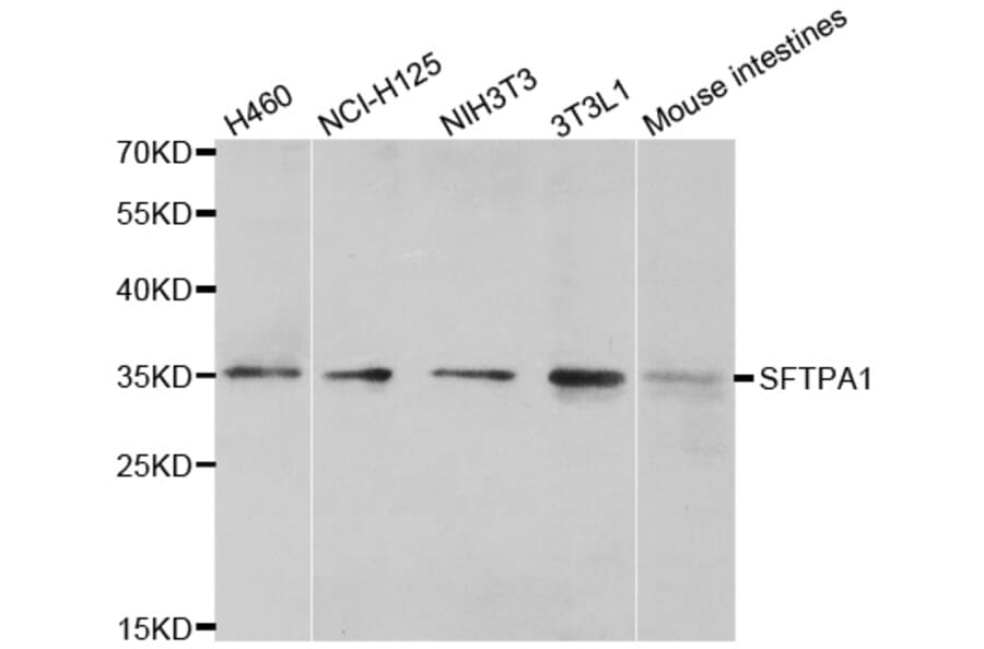 Western blot - SFTPA1 antibody from Signalway Antibody (38598) - Antibodies.com