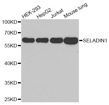 Western blot analysis of extracts of various cell lines, using DHCR24 antibody.