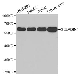 Western blot - DHCR24 antibody from Signalway Antibody (38651) - Antibodies.com
