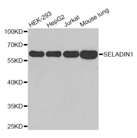 Western blot - DHCR24 antibody from Signalway Antibody (38651) - Antibodies.com