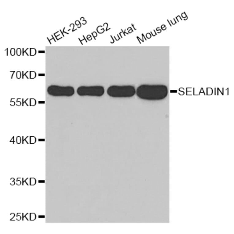 Western blot - DHCR24 antibody from Signalway Antibody (38651) - Antibodies.com