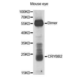 Western blot - CRYBB2 antibody from Signalway Antibody (38669) - Antibodies.com