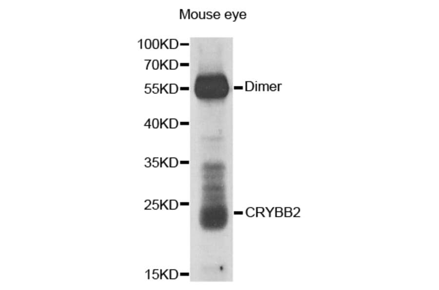Western blot - CRYBB2 antibody from Signalway Antibody (38669) - Antibodies.com