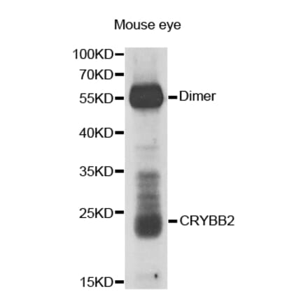 Western blot - CRYBB2 antibody from Signalway Antibody (38669) - Antibodies.com
