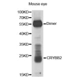 Western blot - CRYBB2 antibody from Signalway Antibody (38669) - Antibodies.com