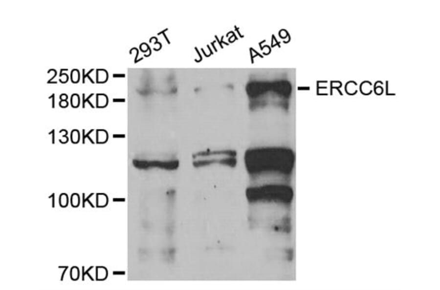 Western blot - ERCC6L antibody from Signalway Antibody (38729) - Antibodies.com