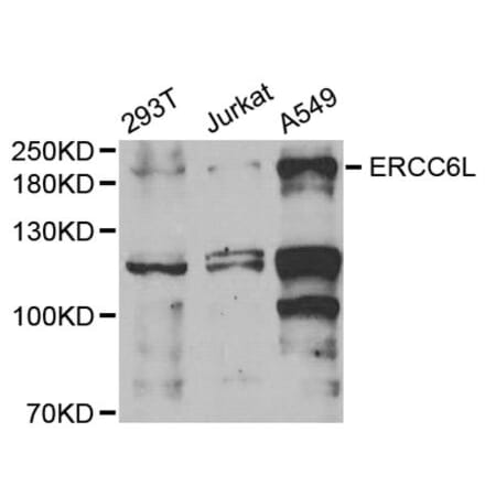 Western blot - ERCC6L antibody from Signalway Antibody (38729) - Antibodies.com