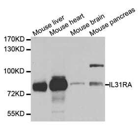 Western blot - IL31RA antibody from Signalway Antibody (38730) - Antibodies.com