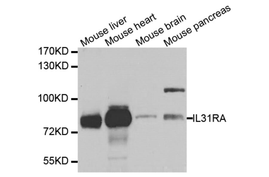Western blot - IL31RA antibody from Signalway Antibody (38730) - Antibodies.com