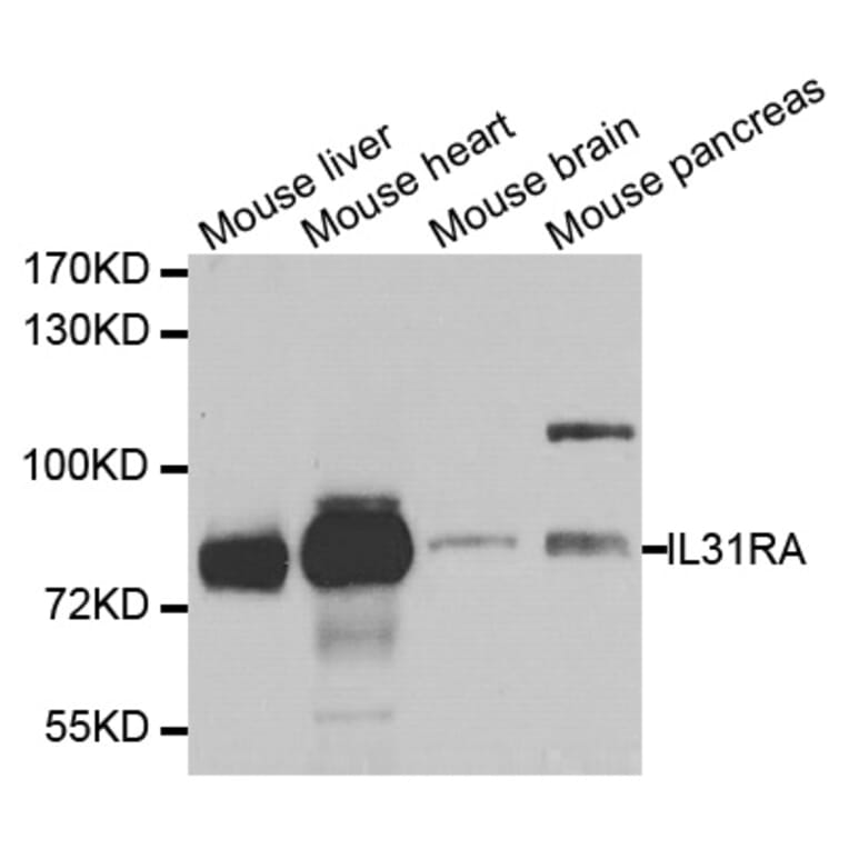 Western blot - IL31RA antibody from Signalway Antibody (38730) - Antibodies.com