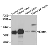 Western blot - IL31RA antibody from Signalway Antibody (38730) - Antibodies.com