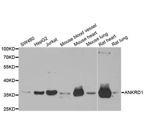Western blot - ANKRD1 antibody from Signalway Antibody (38743) - Antibodies.com