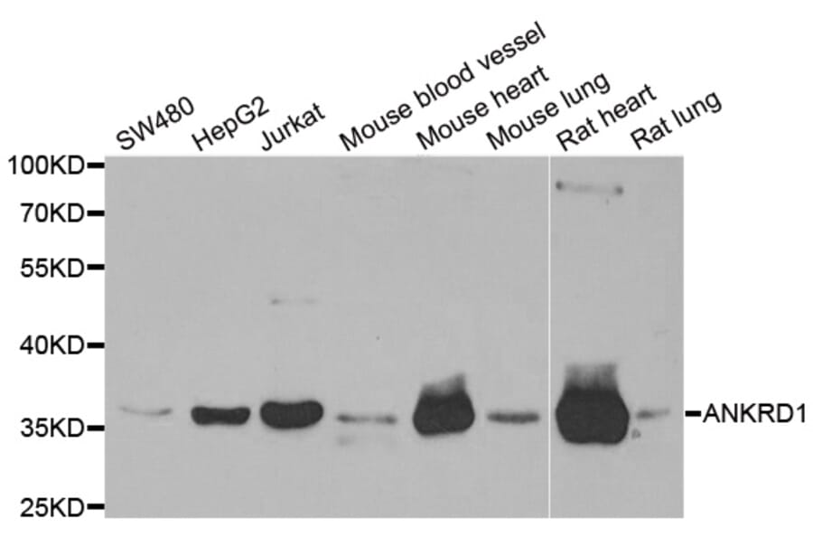 Western blot - ANKRD1 antibody from Signalway Antibody (38743) - Antibodies.com