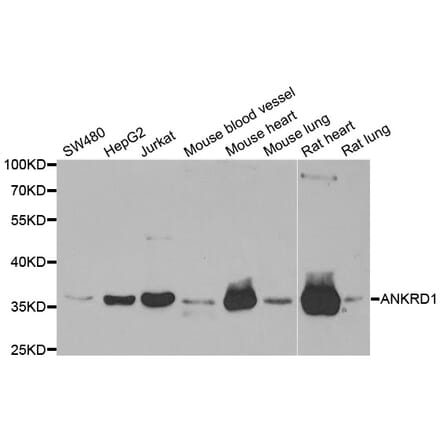 Western blot - ANKRD1 antibody from Signalway Antibody (38743) - Antibodies.com