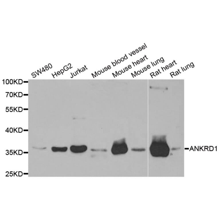 Western blot - ANKRD1 antibody from Signalway Antibody (38743) - Antibodies.com