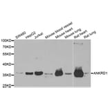 Western blot - ANKRD1 antibody from Signalway Antibody (38743) - Antibodies.com
