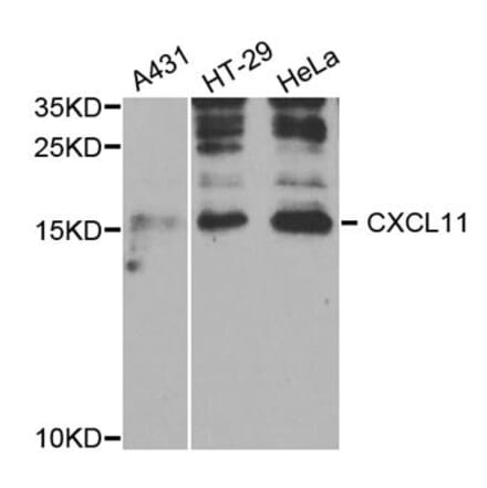 Western blot - CXCL11 antibody from Signalway Antibody (38745) - Antibodies.com