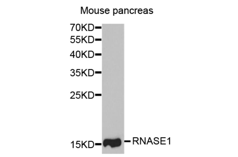 Western blot - RNASE1 antibody from Signalway Antibody (38746) - Antibodies.com