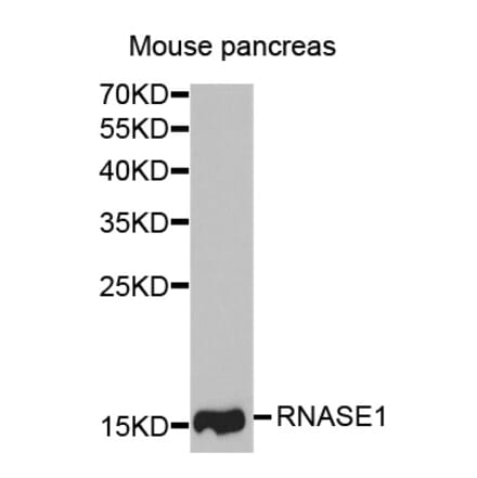 Western blot - RNASE1 antibody from Signalway Antibody (38746) - Antibodies.com
