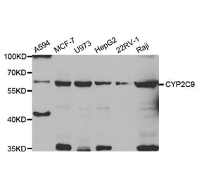 Western blot - CYP2C9 antibody from Signalway Antibody (38755) - Antibodies.com