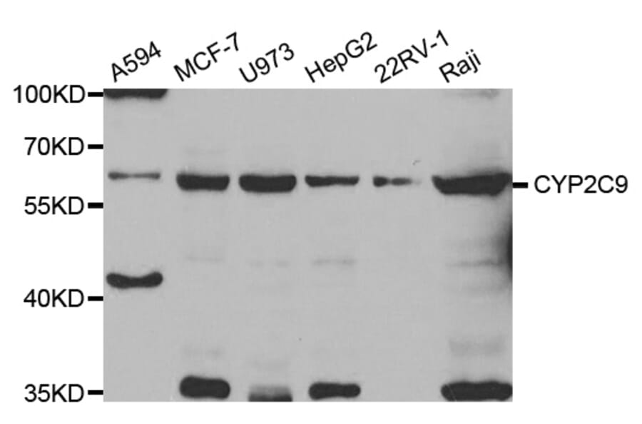 Western blot - CYP2C9 antibody from Signalway Antibody (38755) - Antibodies.com