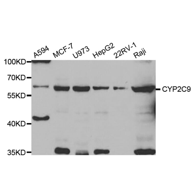 Western blot - CYP2C9 antibody from Signalway Antibody (38755) - Antibodies.com