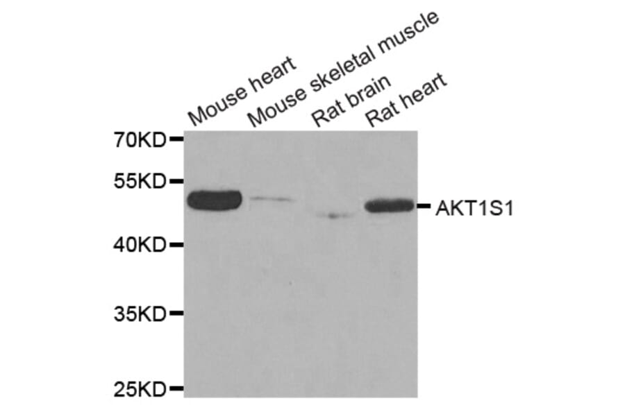 Western blot - AKT1S1 antibody from Signalway Antibody (38768) - Antibodies.com