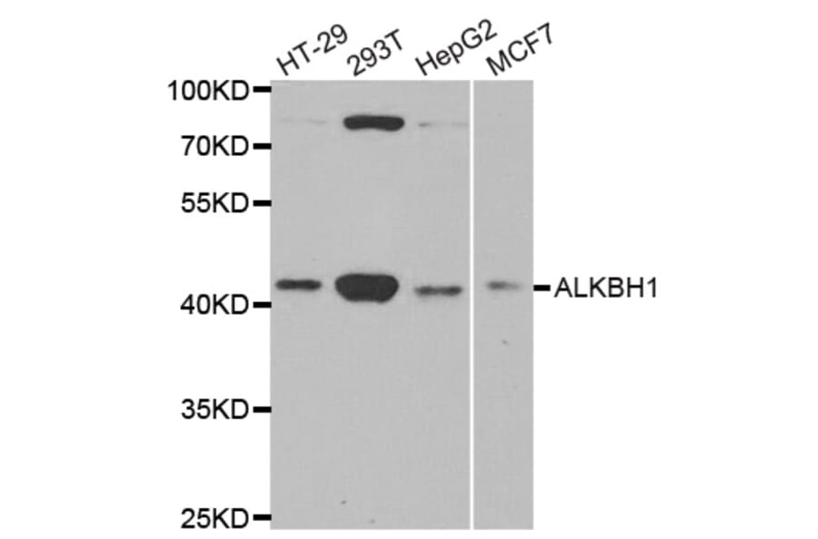 Western blot - ALKBH1 antibody from Signalway Antibody (38770) - Antibodies.com