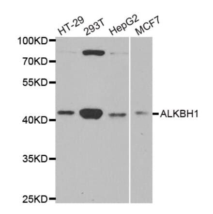 Western blot - ALKBH1 antibody from Signalway Antibody (38770) - Antibodies.com