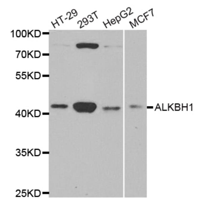 Western blot - ALKBH1 antibody from Signalway Antibody (38770) - Antibodies.com