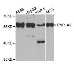 Western blot - PNPLA2 antibody from Signalway Antibody (38772) - Antibodies.com