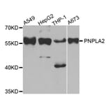 Western blot - PNPLA2 antibody from Signalway Antibody (38772) - Antibodies.com