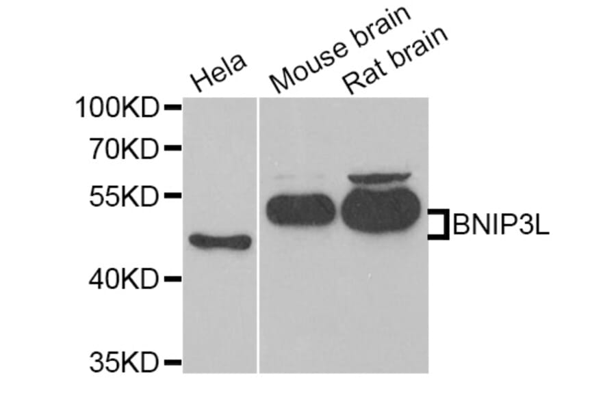 Western blot - BNIP3L antibody from Signalway Antibody (38792) - Antibodies.com