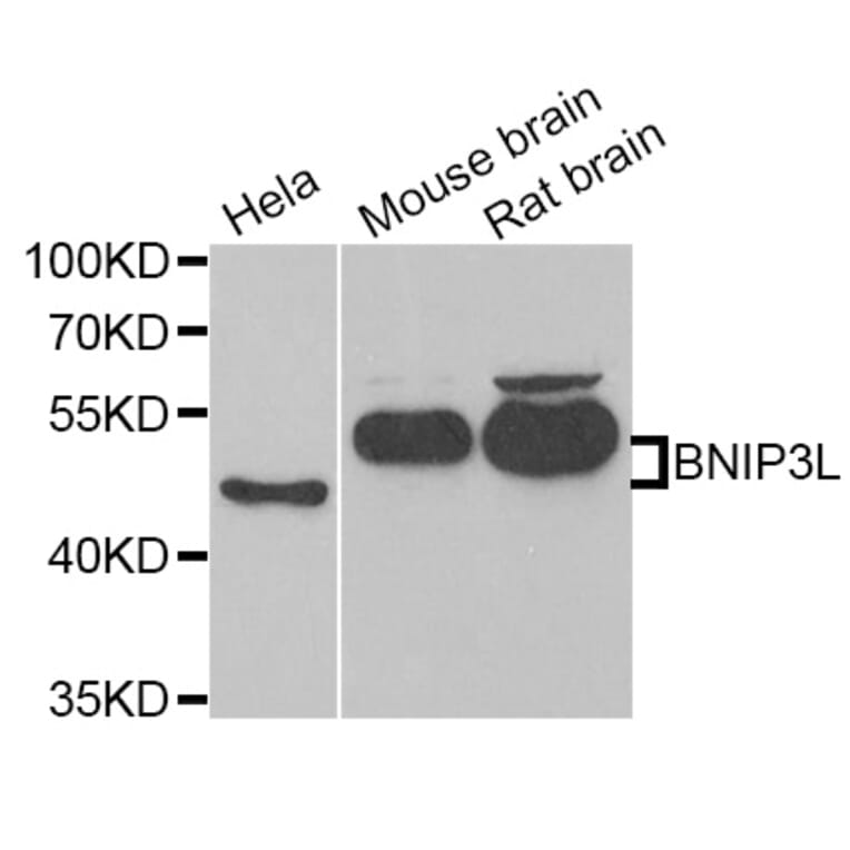 Western blot - BNIP3L antibody from Signalway Antibody (38792) - Antibodies.com