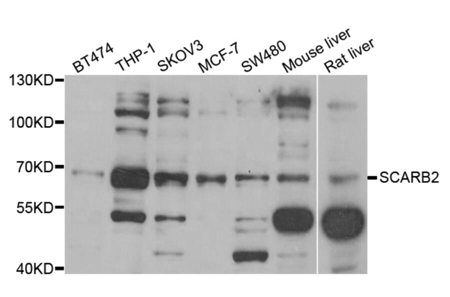 Western blot - SCARB2 antibody from Signalway Antibody (38794) - Antibodies.com