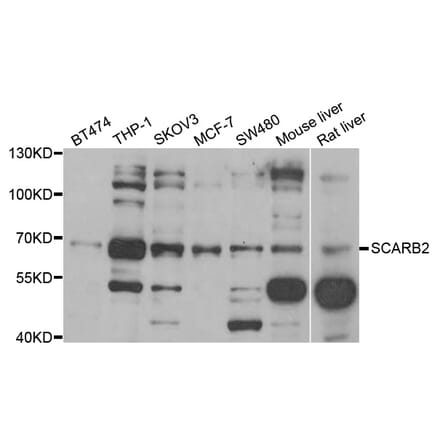 Western blot - SCARB2 antibody from Signalway Antibody (38794) - Antibodies.com