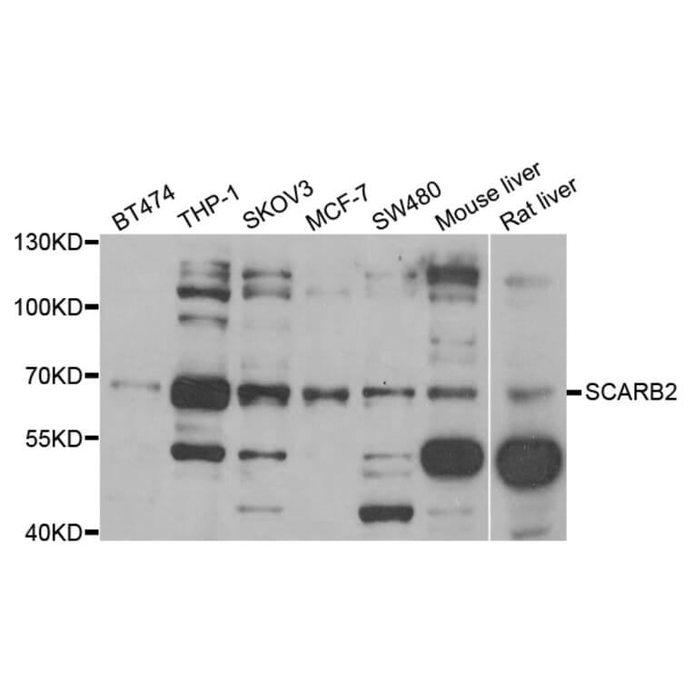 Western blot - SCARB2 antibody from Signalway Antibody (38794) - Antibodies.com