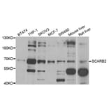 Western blot - SCARB2 antibody from Signalway Antibody (38794) - Antibodies.com